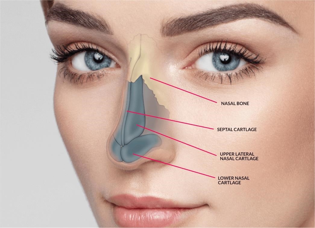 what is a closed rhinoplasty